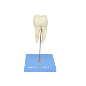 Dente Molar Inferior C/ Raiz Dupla Em 3 Partes C/ Cárie, 8x