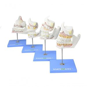 Desenvolvimento da Dentição em 4 Etapas