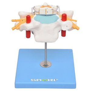 Vértebra Cervical C/cordão Espinhal Modelo Anatomia