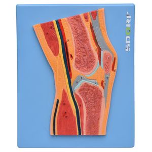 Secção Mediana da Articulação do Joelho Anatomia