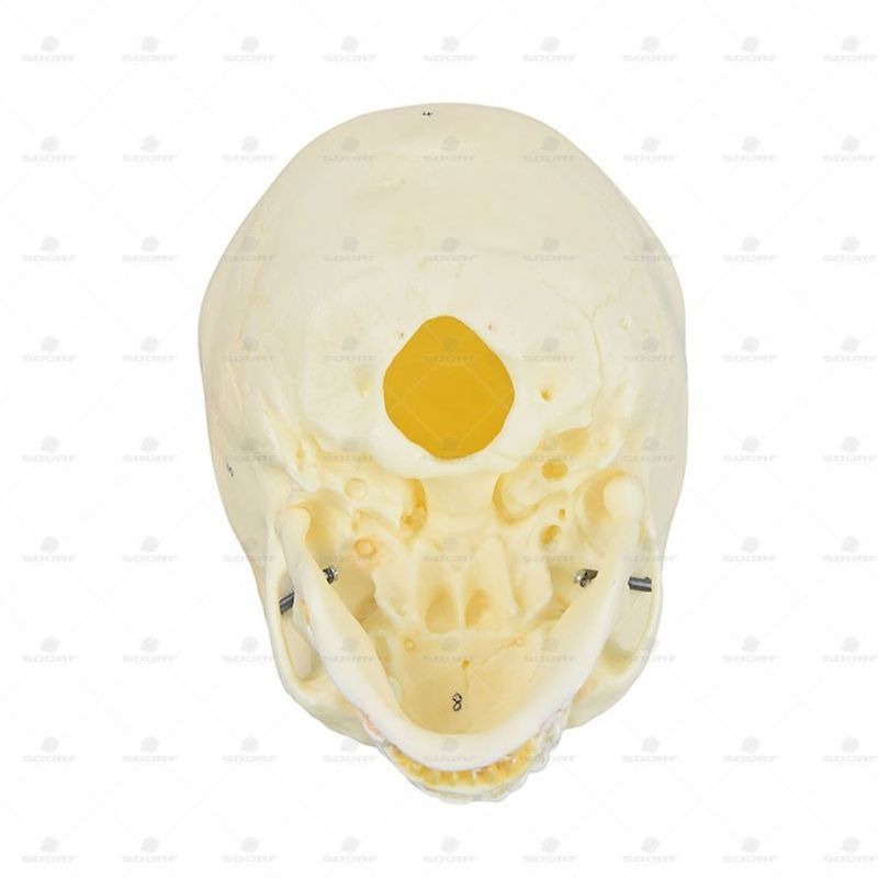 MKP001043000725-2