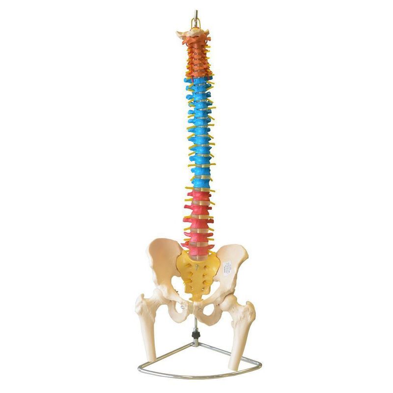 MKP001043000161-1