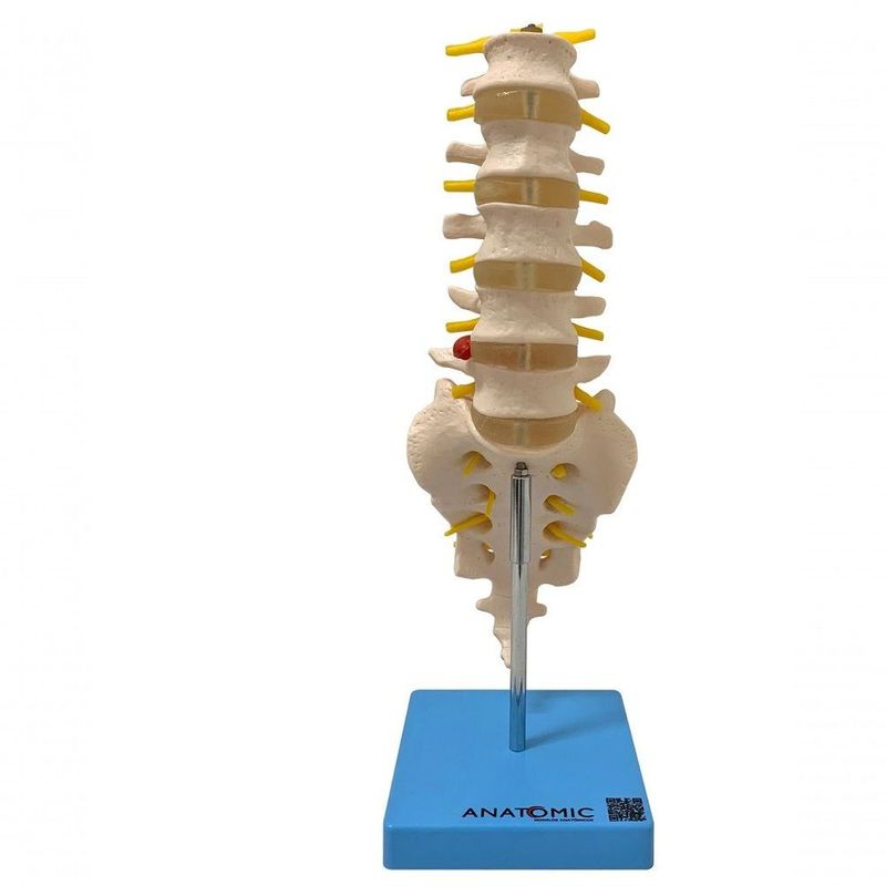 MKP001043000170-1