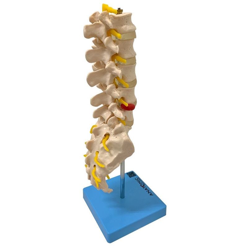 MKP001043000170-2