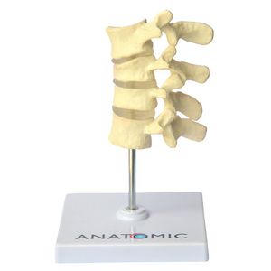 Vértebras Com Osteoporose 4 Vértebras
