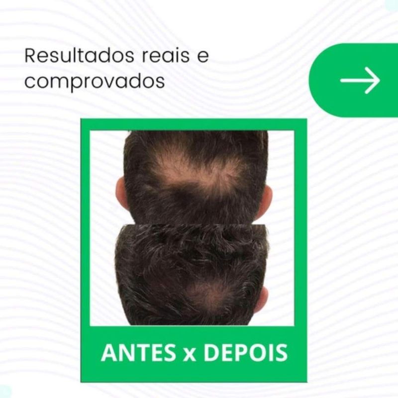 MKP005784000099-2